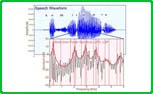 Acoustic Algorithms